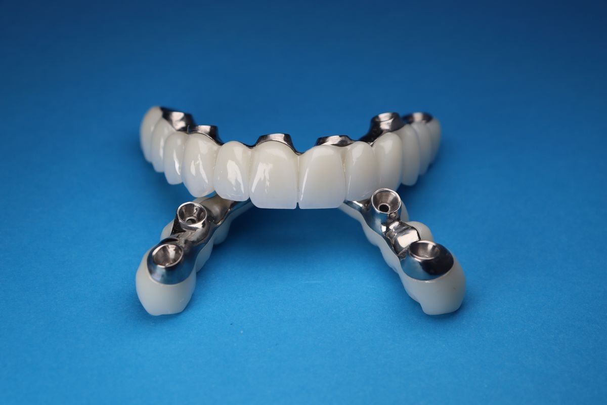 Dental implant prosthetic bridge, close-up product shot